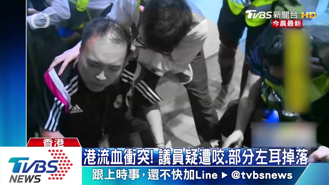 港流血衝突! 議員疑遭咬、部分左耳掉落