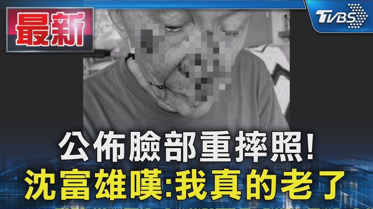 公佈臉部重摔照! 沈富雄嘆:我真的老了|TVBS新聞 @TVBSNEWS01