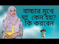 বাচ্চার মুখে ঘা কেন হয়, কি করবেন? Nutritionist Aysha Siddika | Kids