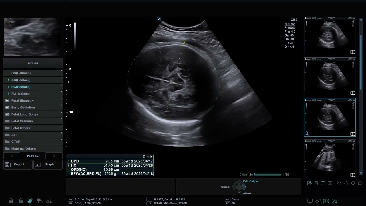 XC6050 Auto biometry