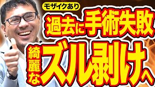【修正手術】過去に失敗した包茎手術痕をキレイに再生する一部始終！