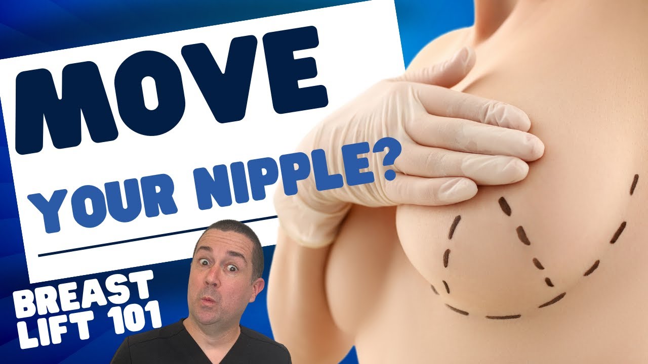 Everything To Know About Breast Lifts! Breast Lift 101 || Austin Breast Lift