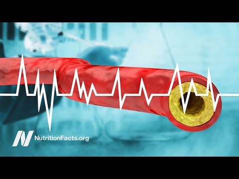 Trans fat saturated fat and cholesterol Tolerable upper intake of zero