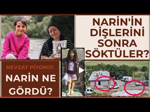 INTERESTING PHOTOS!!! Narin's Teeth Were Later Removed - Her Leg Was Placed Somewhere Else