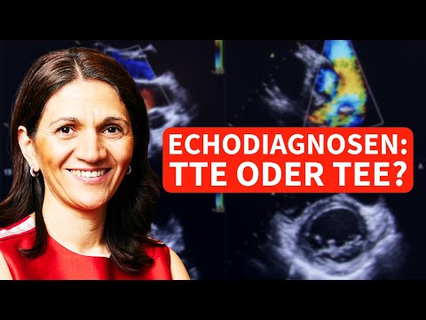 TEE oder TTE? - Diese Klassiker kannst du im TEE besser diagnostizieren als im transthorakalen Echo