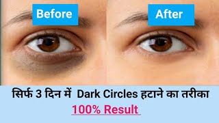 dark circles under eyes home remedy  | how to remove dark circles | dark circles kaise hataye