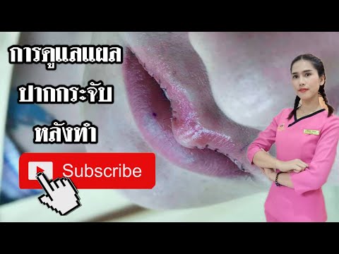 ทําปากกระจับ