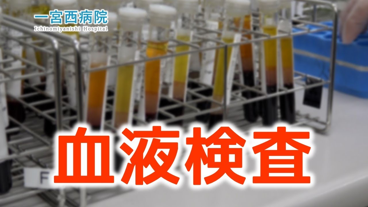今すぐ見るWcc 血液検査 Wcc 血液検査