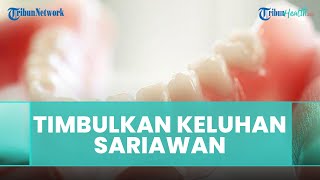 Apakah Penggunaan Gigi Palsu di Awal Pemakaian Dapat Timbulkan Sariawan? Ini Penjelasan Dokter Gigi