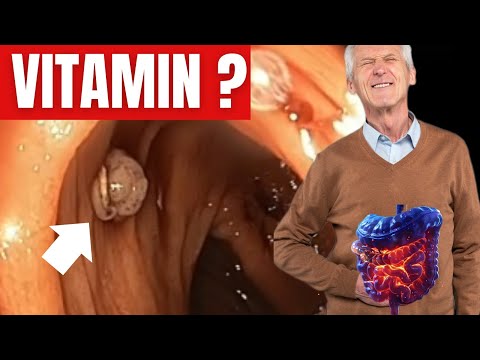 The Most Important VITAMIN for Preventing Colorectal Cancer !