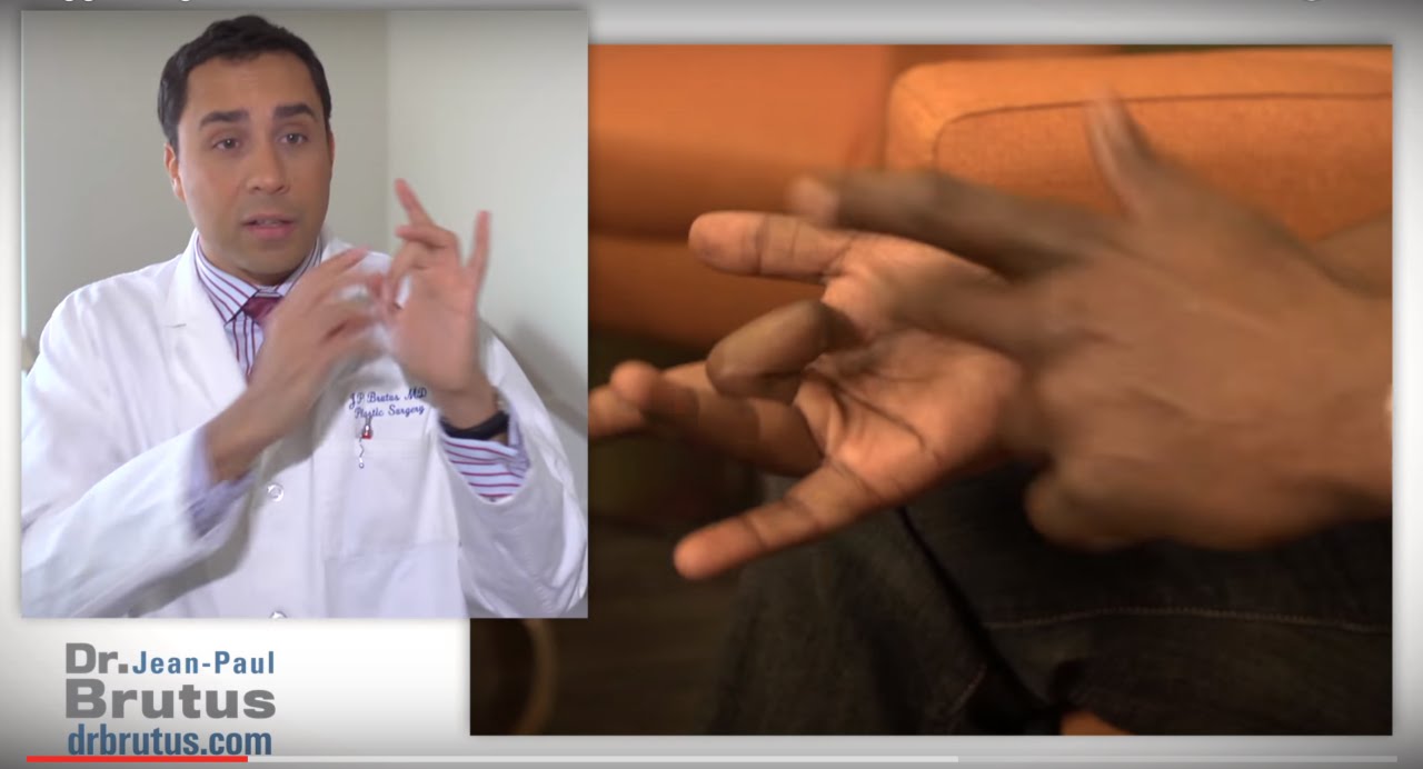 Watch video Doigt à Gâchette - Dr. Jean-Paul Brutus Doigt à Gâchette - Dr. Jean-Paul Brutus