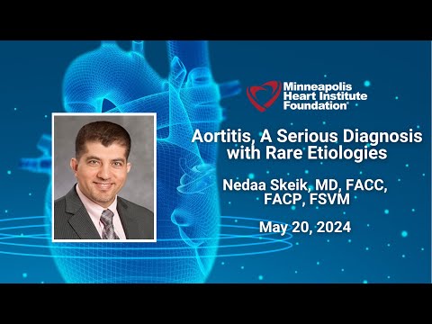 Aortitis, A Serious Diagnosis with Rare Etiologies | Nedaa Skeik, MD, FACC, FACP, FSVM