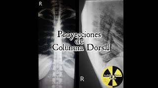 Columna Dorsal