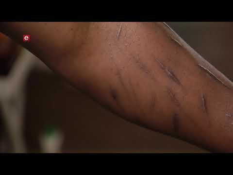 Checkpoint EP 227 eTV Topical