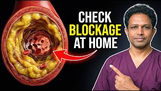 How to Check for Blocked Leg Arteries at Home | ABI Test for Peripheral Artery Disease