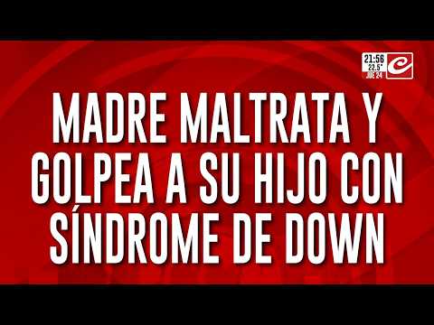 ¡Horror en Chaco! Denuncian a una madre por golpear a su hijo con síndrome de Down