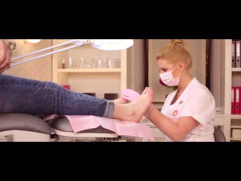 Deformacja stóp u dzieci zawarta Guz na nodze kciukiem na co