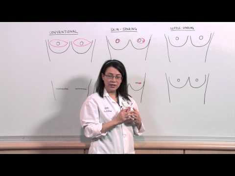 Types of Mastectomies: What is nipple-sparing reconstruction? - Sonia Sugg, MD