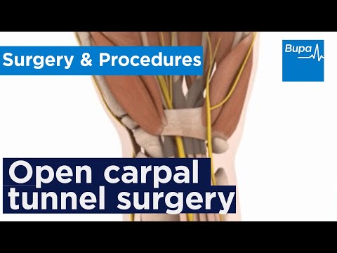 How open carpal tunnel surgery is carried out | Bupa Health