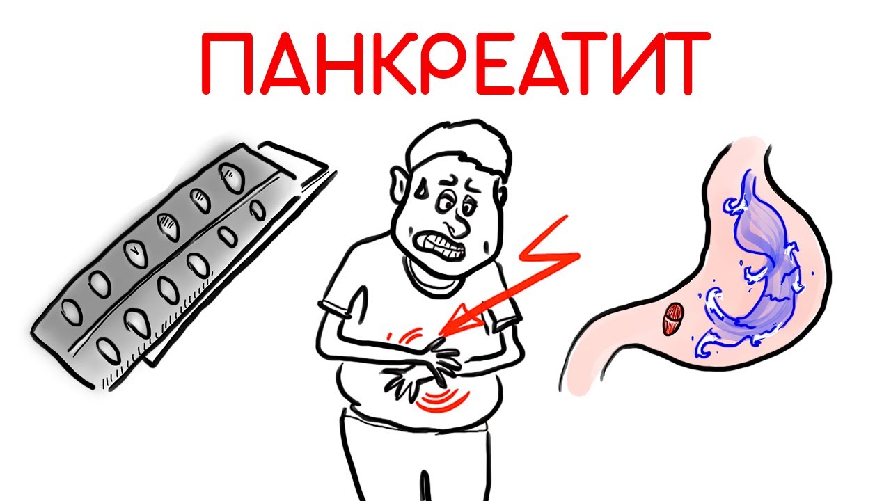Хронический панкреатит: почему лекарства не помогают // Доктор Ху
