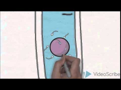 CONCEPCIÓN DESVIRTUADA (FECUNDACIÓN IN VITRO)