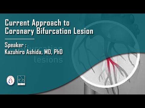 Current Approach to Coronary Bifurcation Lesion