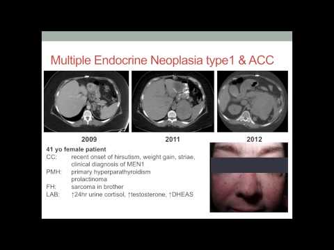 Symposium 16, Pathogenesis of adrenocortical tumours: Tobias Else