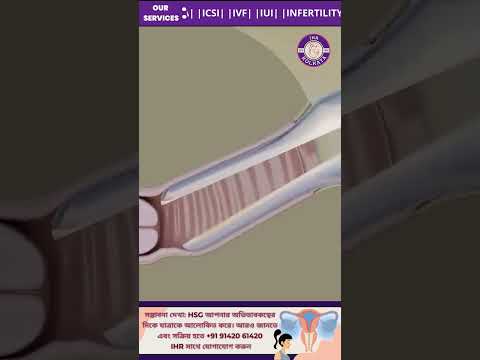 Is HSG Test Painful?