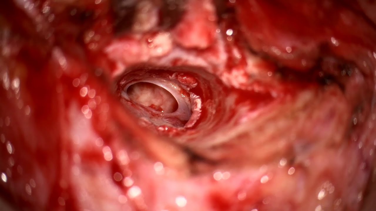 Rubén Polo López-15