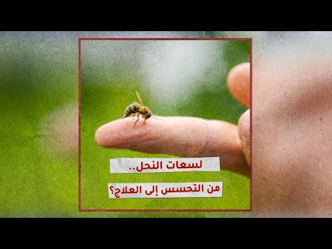 «تحقيقات»: لسعات النحل.. من التحسس إلى العلاج؟