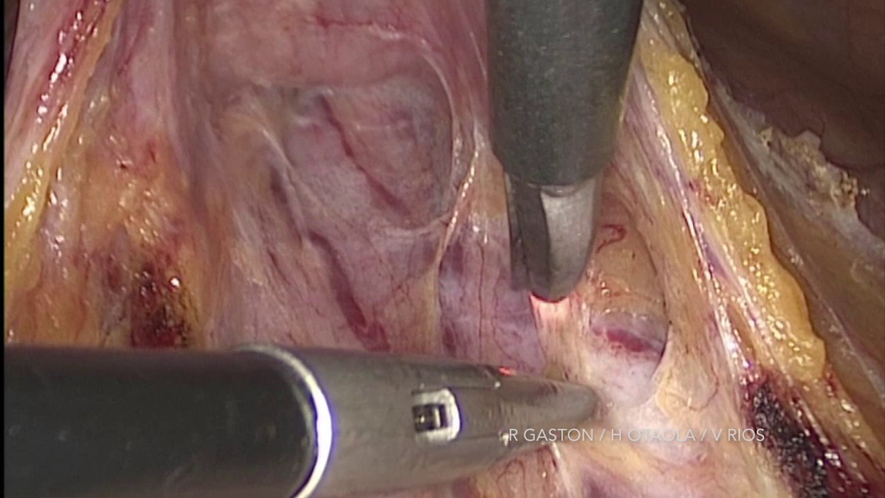 Víctor Ríos Dávila-52