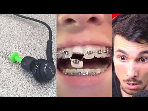 All your PAIN in ONE VIDEO!!