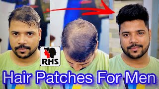 Hair Patches For Men | Hair Transformation | Natural Hairline Patch | Clipping System Hair Patch |