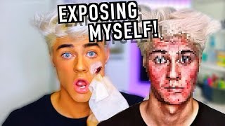 Why I Wear Makeup.... my BIGGEST INSECURITY ever!
