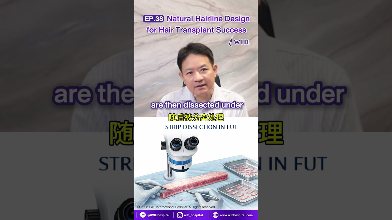 EP.38 | Natural Hairline Design for Hair Transplant Success