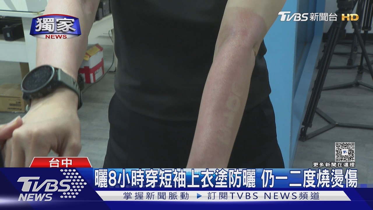 獨/女鐵人完賽代價慘烈!8小時曝曬「全身包成木乃伊」連被子都掀不動