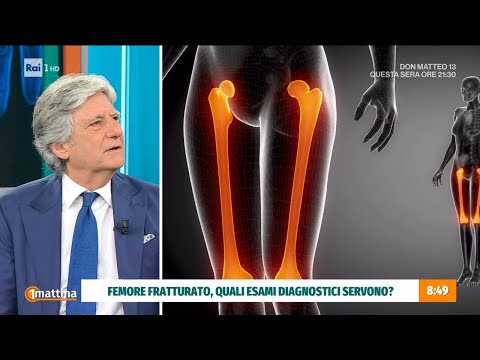 La frattura femore: può essere composta o scomposta - Unomattina 29/05/2025