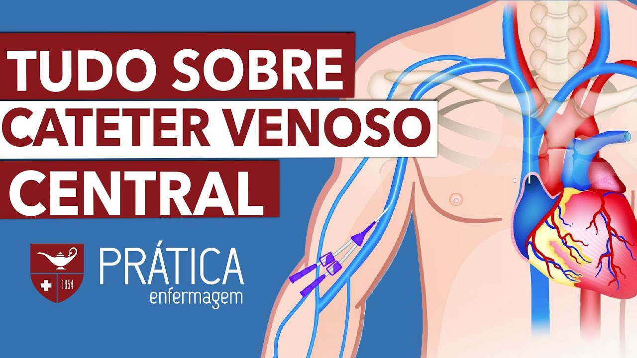 CATÉTER CENTRAL ou PICC