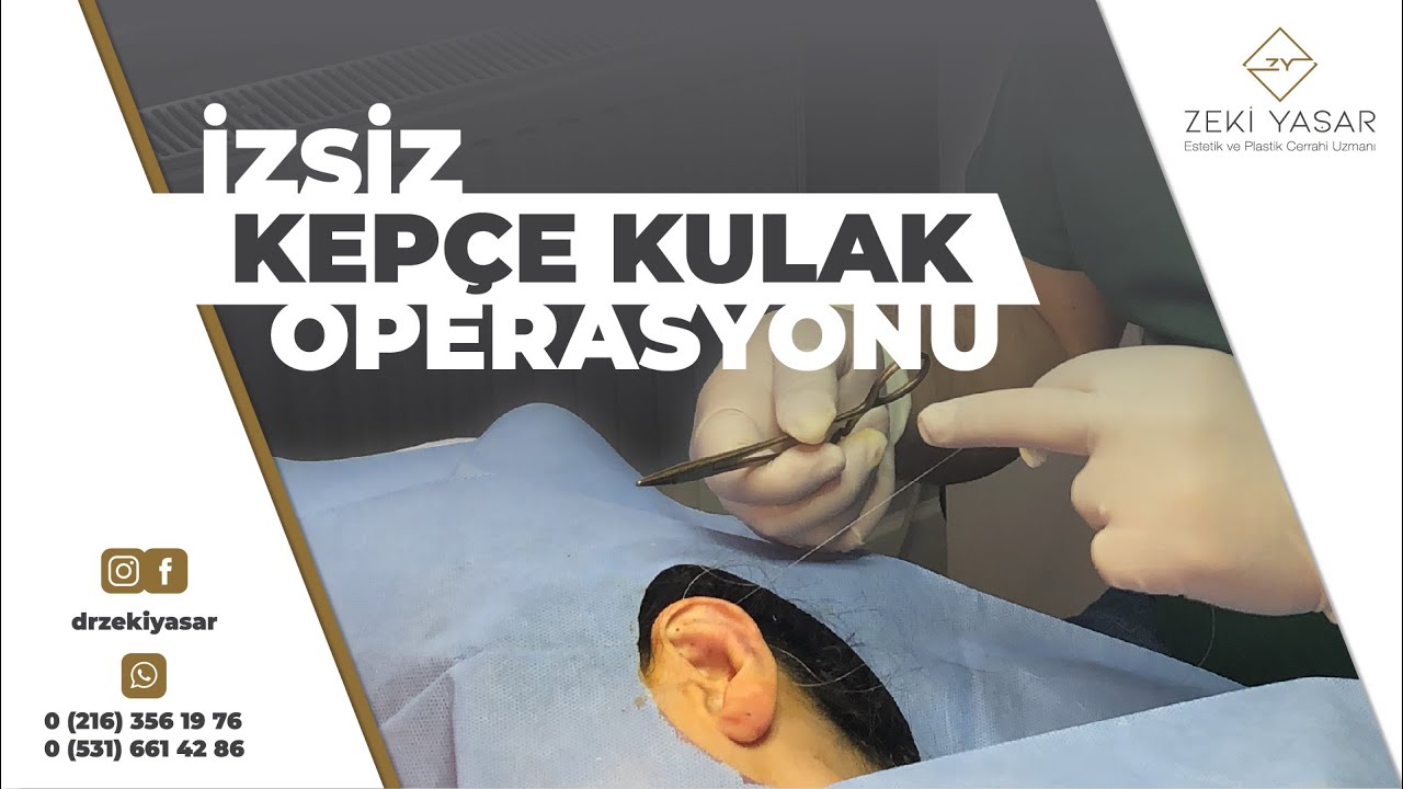 Kepçe Kulak Operasyonu