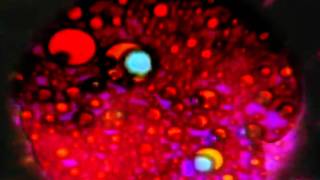 Fever Dream - This Waste