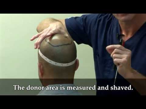 Aldo's Surgery