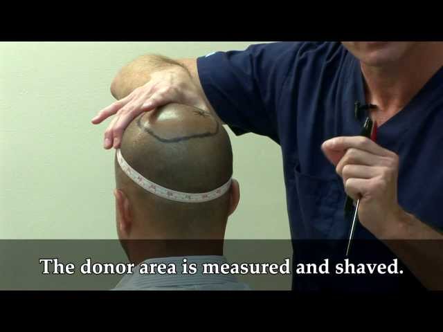 Aldo's Surgery