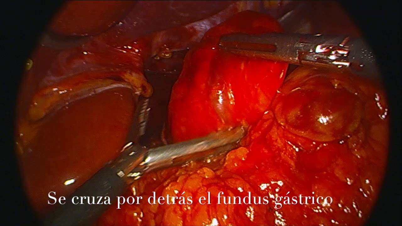 Juan Pablo Marin Calahorrano-3