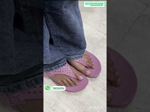 Rayon Rehab Custom Silicone Partial Foot Prosthesis, Below the Knee