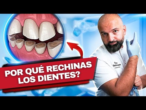 Rechinar los Dientes es Peligroso! Todo sobre el Bruxismo y Cómo Solucionarlo