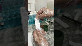 Drug checking test in laboratory | TLC |
