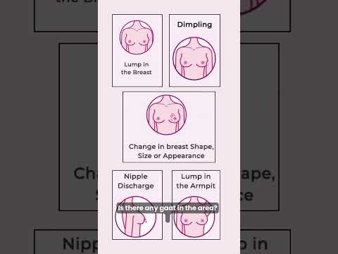 Self-Examination: Your Monthly Routine