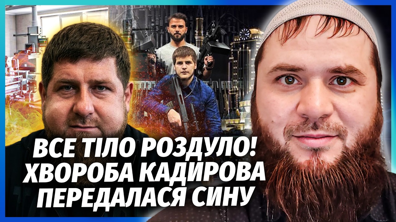 ❗️ЛІКАРІ ОФІГІЛИ! В АДАМА КАДИРОВА УРАЖЕННЯ МОЗКУ. Проявилась РІДКІСНА АЛЕ?
