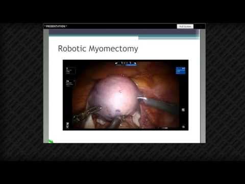 Chirurgia robotowa w endokrynologii rozrodu i niepłodności