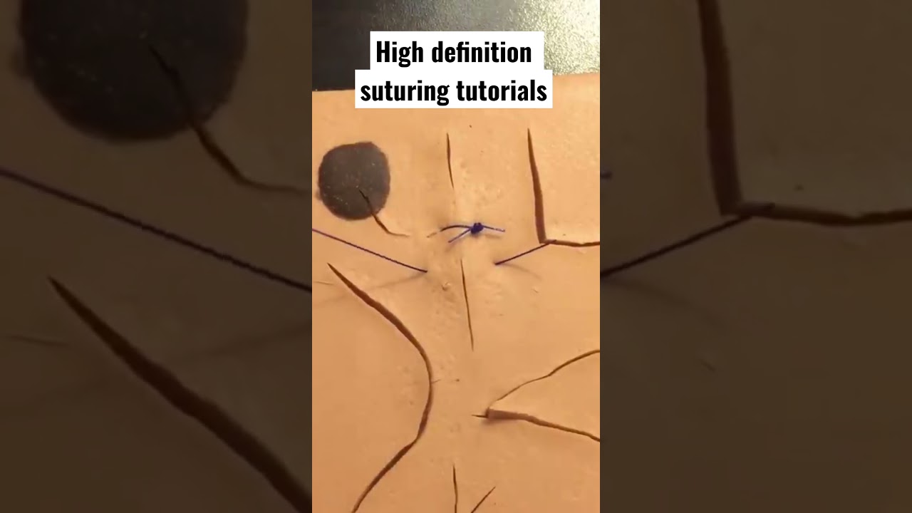 Simple interrupted suturing in HD 🩺 🏥
